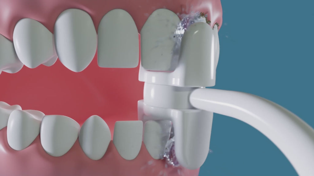 Miracle Smile – Irrigador dentário duplo